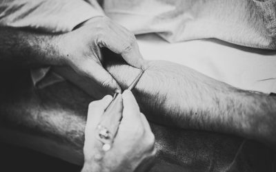 Fisioterapia invasiva